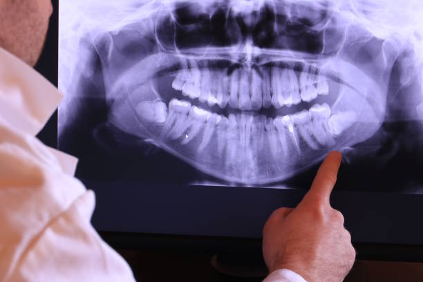 Best Emergency Treatment for Toothache in Mount Olive, NC