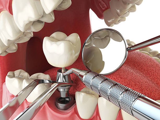 Best Emergency Treatment for Toothache in Mount Olive, NC